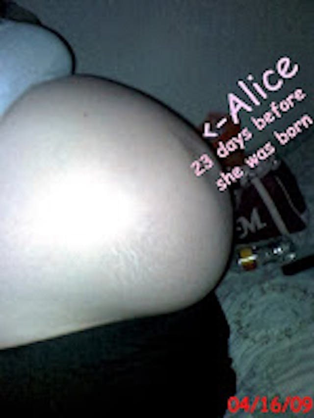 Michelle Olson with unborn Alice