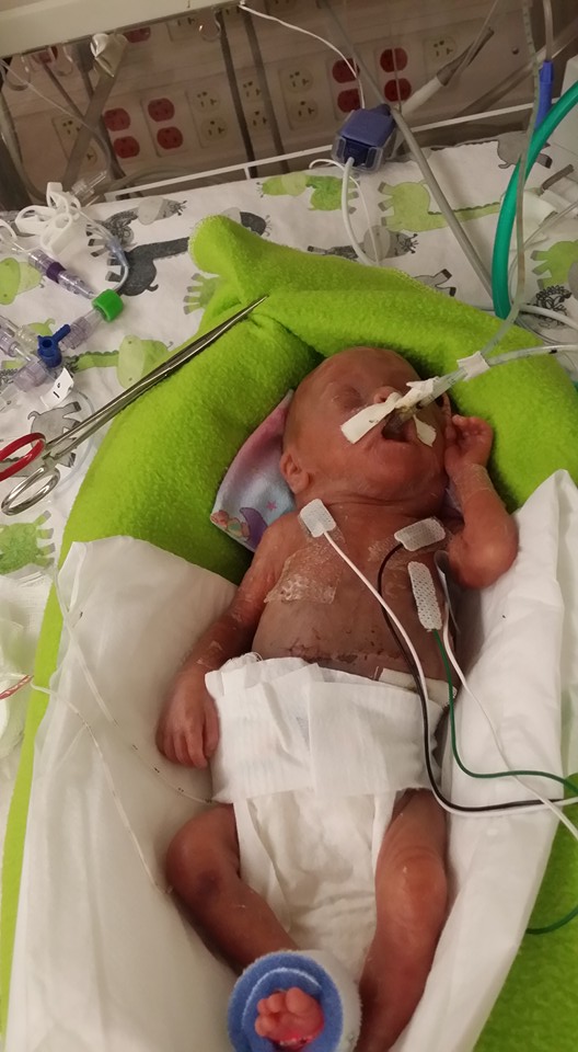 Baby Wrennyn (via Jimmy Weeks' Facebook page)