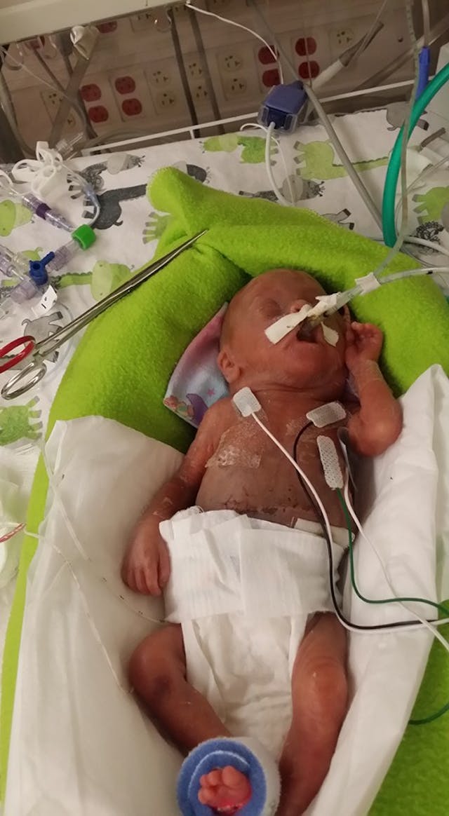 Baby Wrennyn (via Jimmy Weeks’ Facebook page) Baby Wrennyn (via Jimmy Weeks' Facebook page)