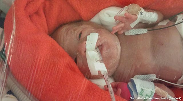 Baby JB baby-JB-Weeks