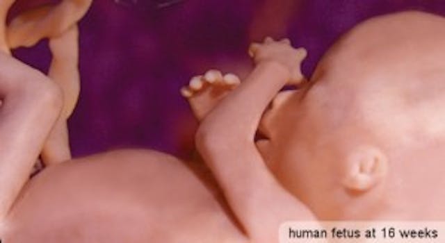 Photo: Life Issues Institute (Human at about 16 weeks gestation) Human at about 16 weeks gestation.