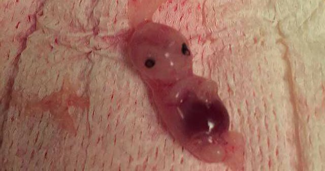 Christina’s 7-week-old baby died after she took the abortion pill. Photo courtesy of Christina and used with permission. 12722144_1968099360081970_143384311_n