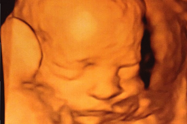 Permission for this article by Patrick Neville