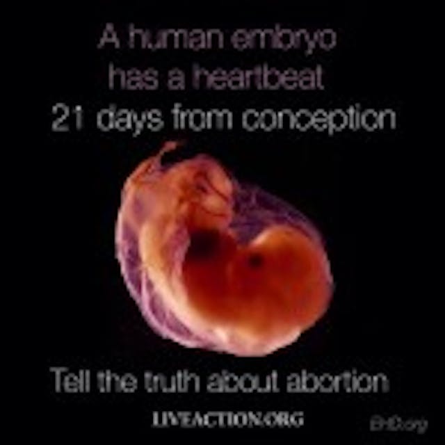 But "was never actually alive," according to Planned Parenthood.