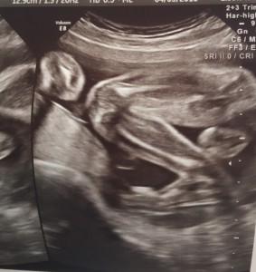 Little Grace-Lynn's dancing legs