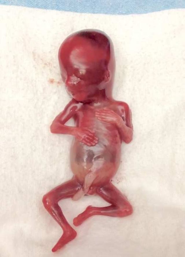 NoahSmith_505_701_55