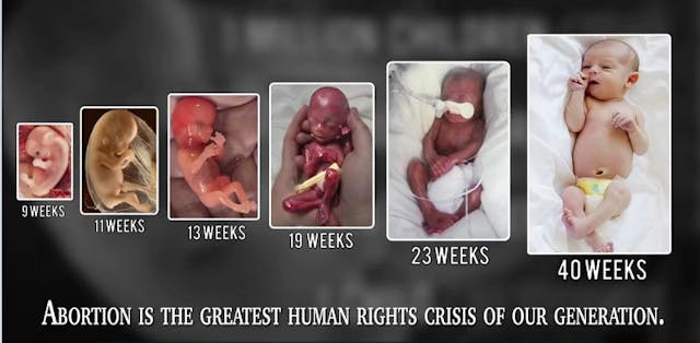 ABortion human rights late term Live Action