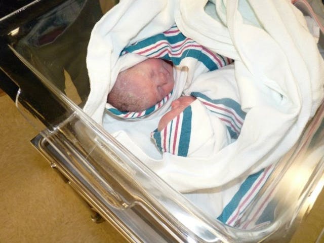 Shelley's twins, twin to twin transfusion, permission granted for this article