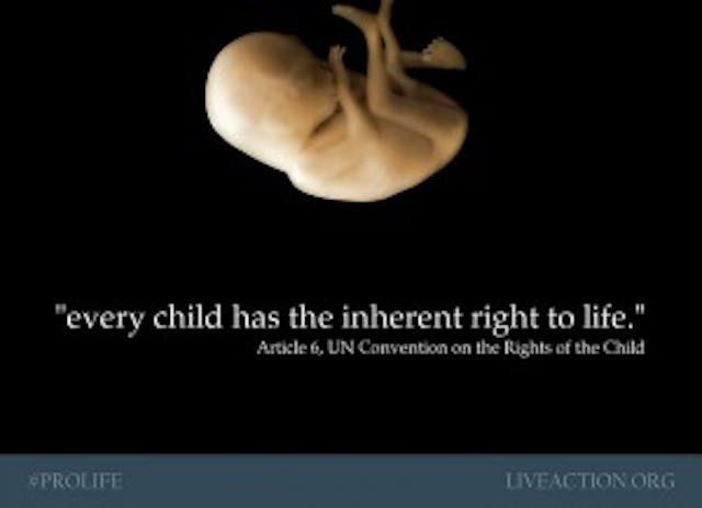 UN, united nations, life, right, fetus, baby