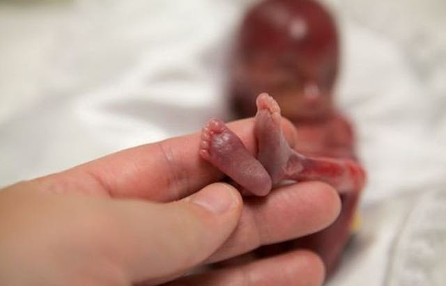 Miscarried at 19 weeks, baby Walter’s life is changing the abortion debate image