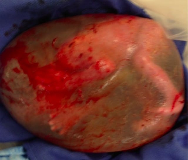 Photo: Cedars-Sinai Medical Center