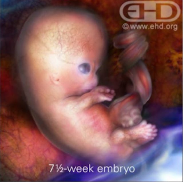 7 1/2 week old embryo, baby