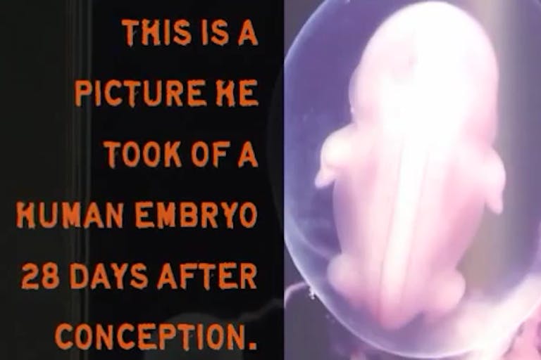 baby, embryo, fetus, conception, prenatal, 28 days, development