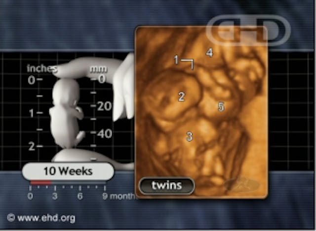 "Twins at Play"