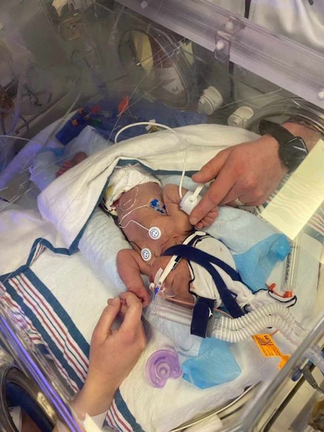 Photo courtesy of Jillian O’Connor We chose life over abortion after a grim prognosis… and our son beat the odds image