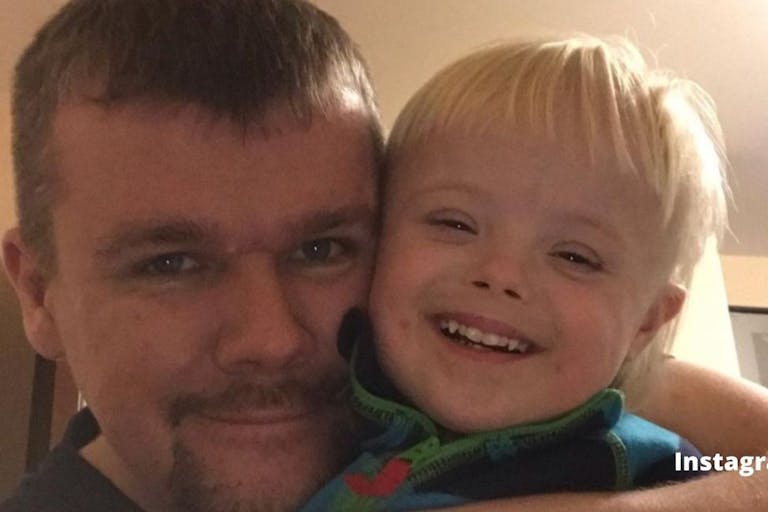 Down syndrome, instagram