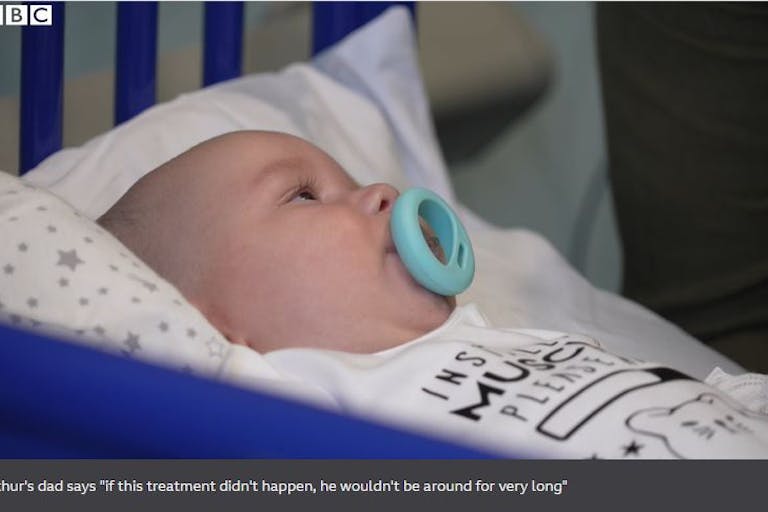 SMA, spinal muscular atrophy