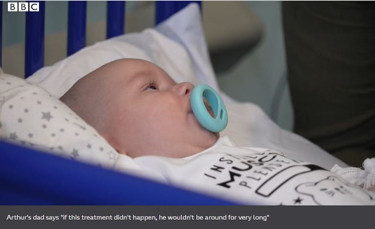 SMA, spinal muscular atrophy