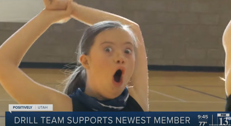 Down syndrome