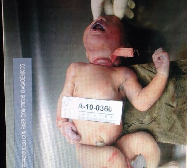 Daughter of María del Tránsito Orellana Martínez. El Salvador Legislative Assembly shelves bill to legalize abortion image