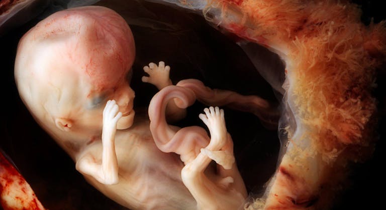 preborn baby