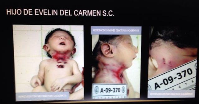 Daughter of Evelyn del Carmen Sánchez Cabrera who confessed to killing the newborn. El Salvador Legislative Assembly shelves bill to legalize abortion image