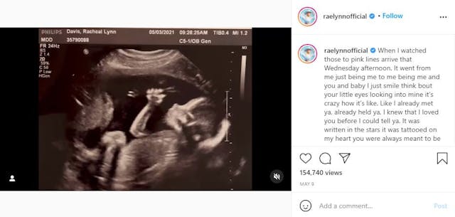 raelynn sonogram instagram