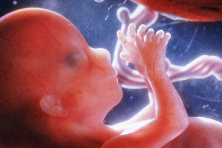 dismemberment abortion