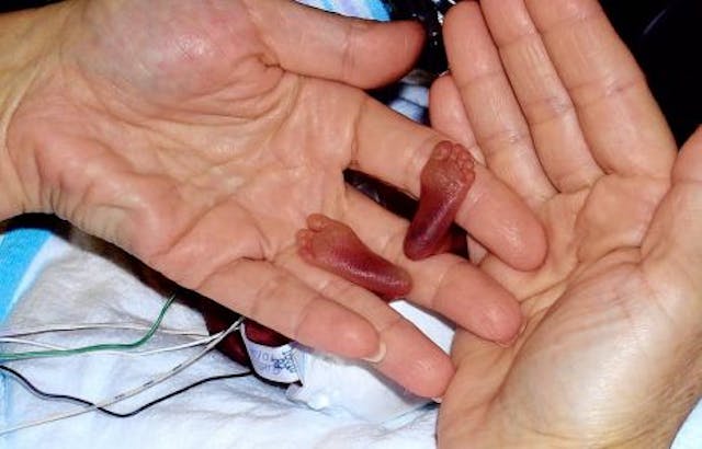 Amillia Taylor's tiny feet.