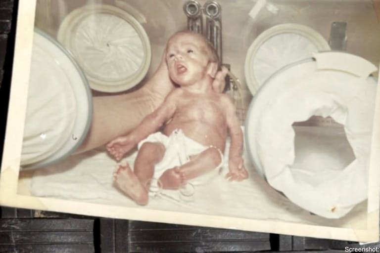 preemie cbc news dr. donald craig Doctor reunites with preemie he saved decades ago after anticipating a stillbirth featured image