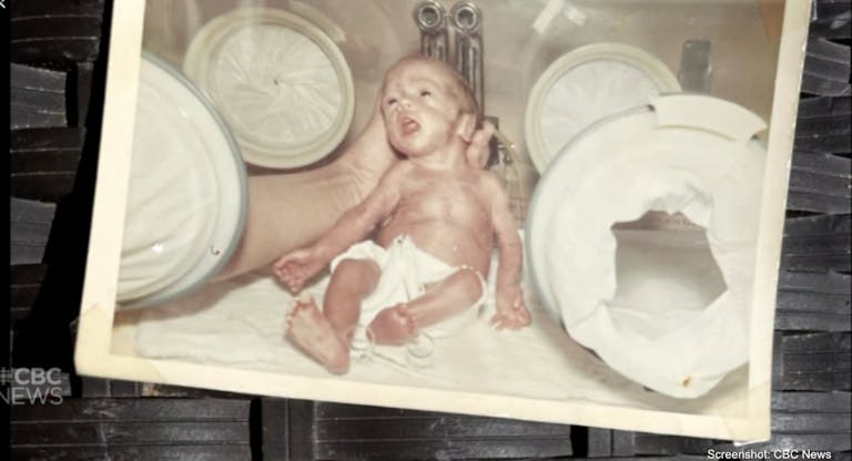 Doctor reunites with preemie he saved decades ago after anticipating a stillbirth featured image