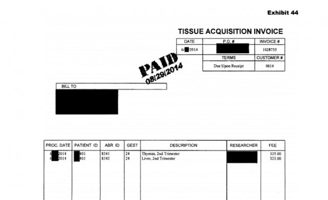 Report shows abortion industry trafficked organs of 24-week babies image