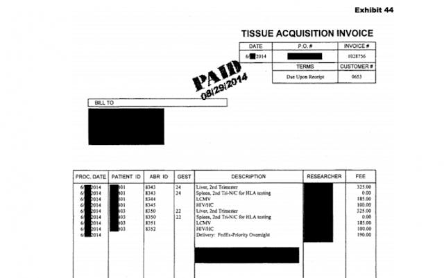 Report shows abortion industry trafficked organs of 24-week babies image