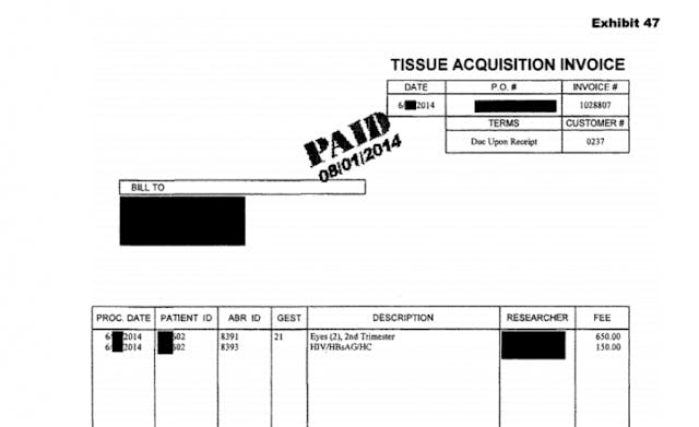Report shows abortion industry trafficked organs of 24-week babies image