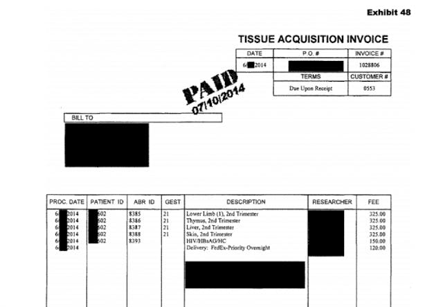 Report shows abortion industry trafficked organs of 24-week babies image