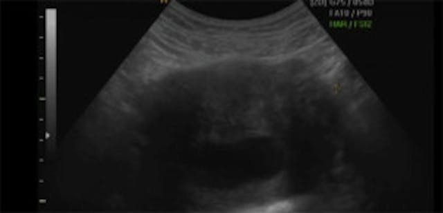 Beyonce-Sonogram-jpg_163309