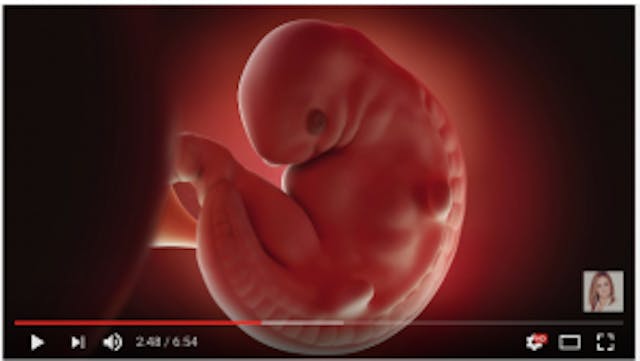 Bee deceives on ‘extreme’ Ohio abortion laws image