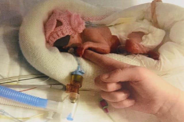 Born premature at 24 weeks, ‘miracle’ baby Francesca is beating all odds image