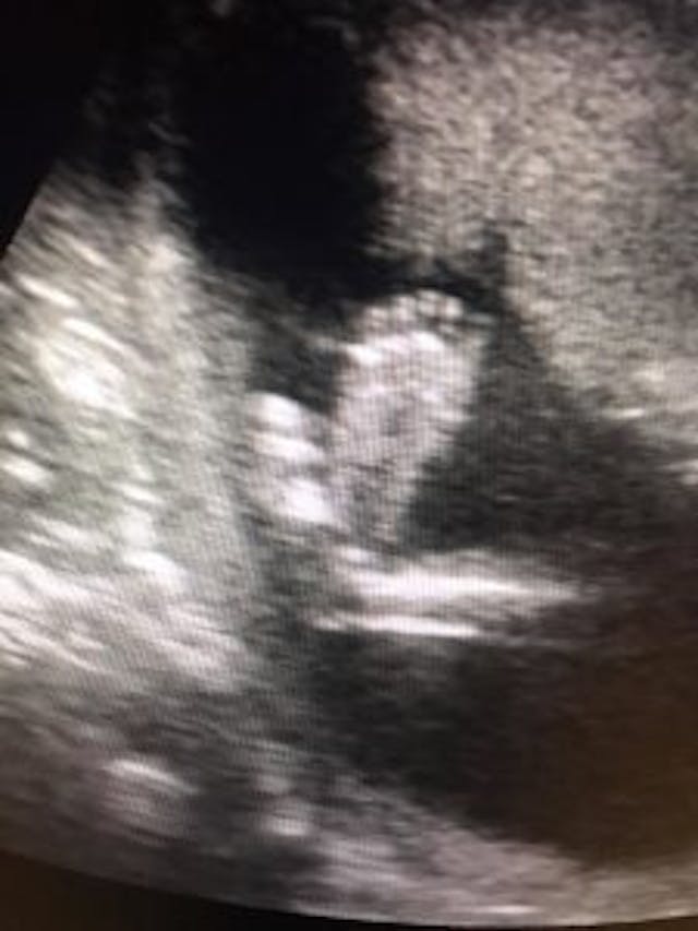 photo from Lupe Reyes