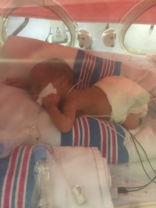 Meet babies born at 24 weeks, the same age Planned Parenthood is willing to kill them image