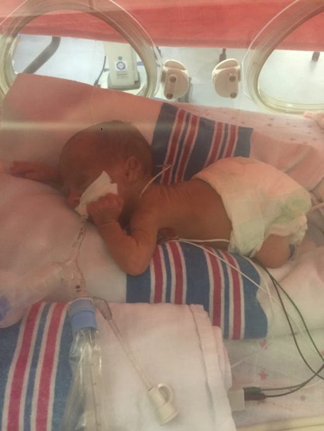 Meet babies born at 24 weeks, the same age Planned Parenthood is willing to kill them image