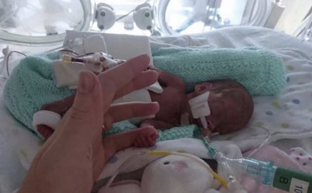Meet babies born at 24 weeks, the same age Planned Parenthood is willing to kill them image