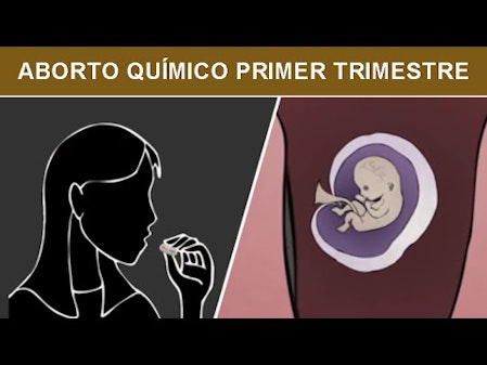 Aborto Químico durante el Primer Trimestre thumbnail