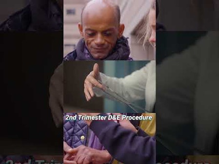 It's hard to watch abortion videos and not become pro-life. thumbnail