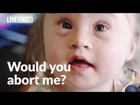 Abortion rejected by parents of child with Down syndrome thumbnail