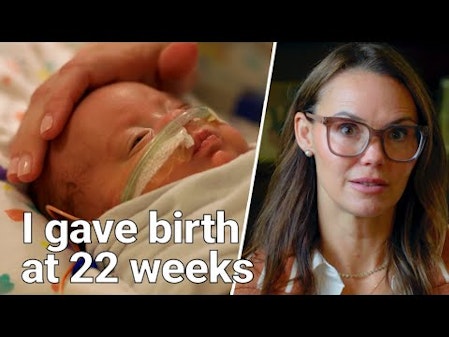 One Of The World’s Youngest Babies To Survive thumbnail