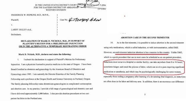Abortionist Mark Nichols’ testimony – induction abortions in hospitals Image: Abortionist Mark Nichols Standard of Care testimony induction abortion in hospitals