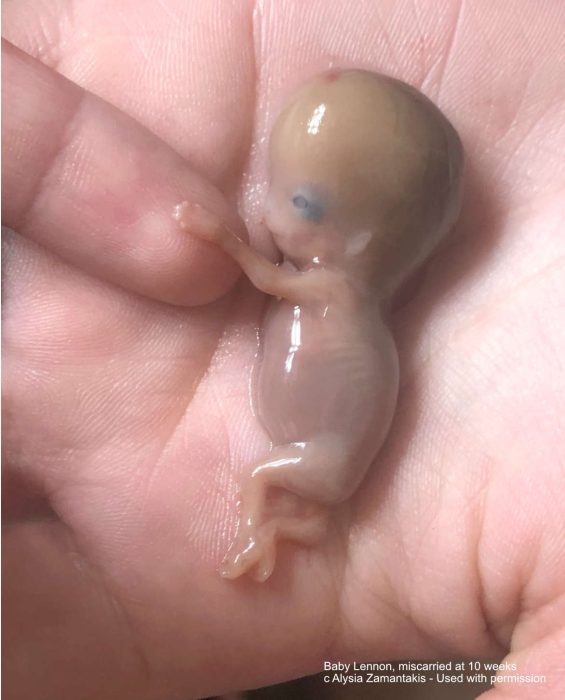 EXCLUSIVE: Undercover video shows Virginia abortionist saying it’s ‘easy’ to dismember babies image