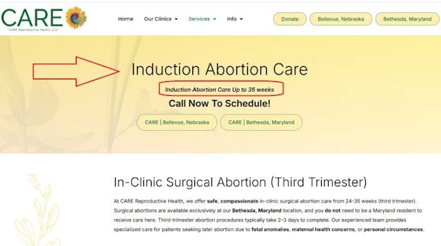 CARE late term induction abortion to 35 weeks