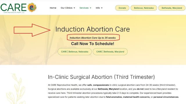 CARE late term induction abortion to 35 weeks CARE late term induction abortion to 35 weeks